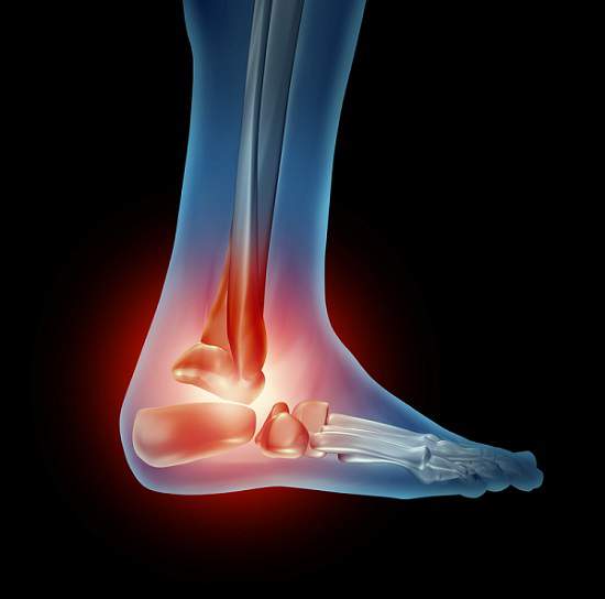 Ankle Pain